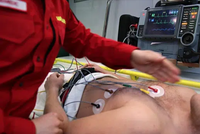 How to Read Hospital ICU Monitor
